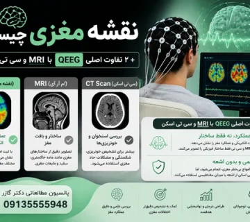 Qeeg   نقشه مغزی